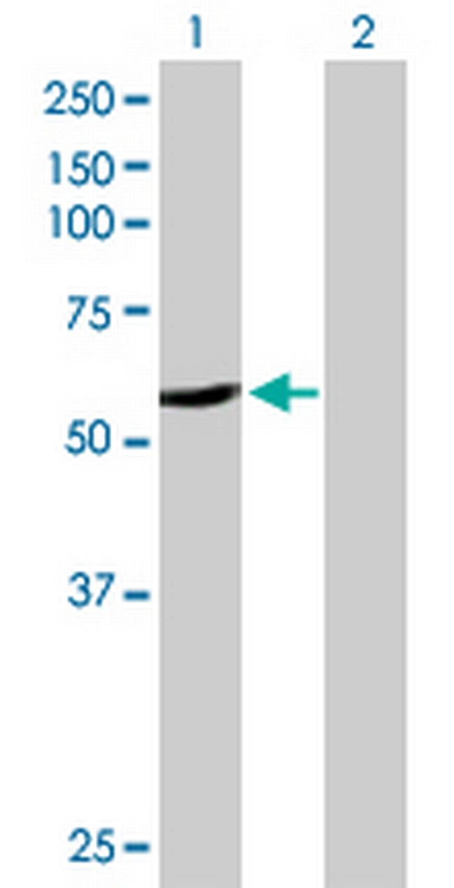 CYP2A6 Antibody in Western Blot (WB)