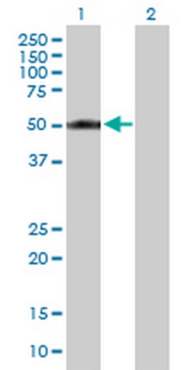 CYP2A13 Antibody in Western Blot (WB)