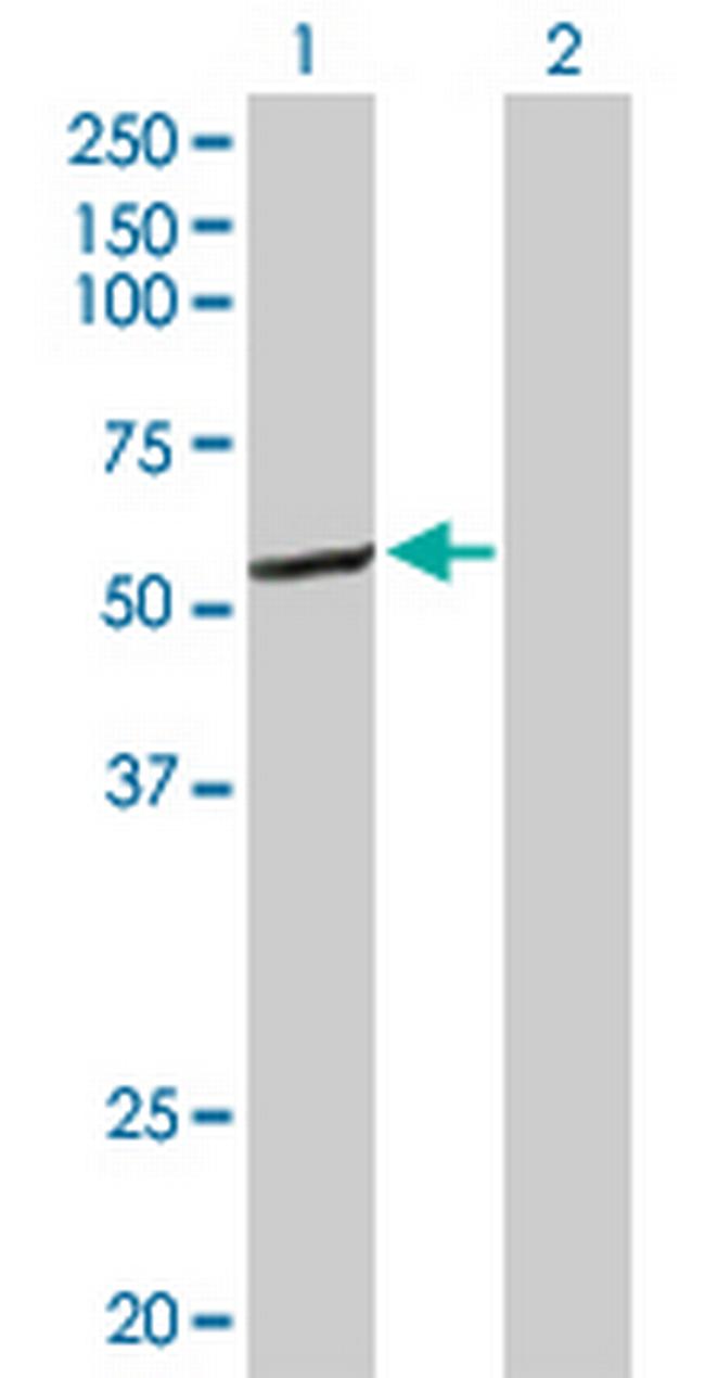 CYP2C8 Antibody in Western Blot (WB)