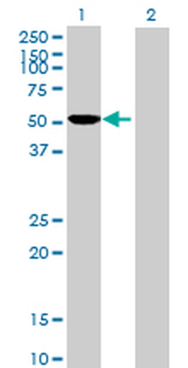 CYP2D6 Antibody in Western Blot (WB)