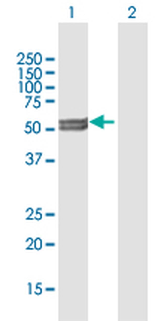 CYP11A1 Antibody in Western Blot (WB)