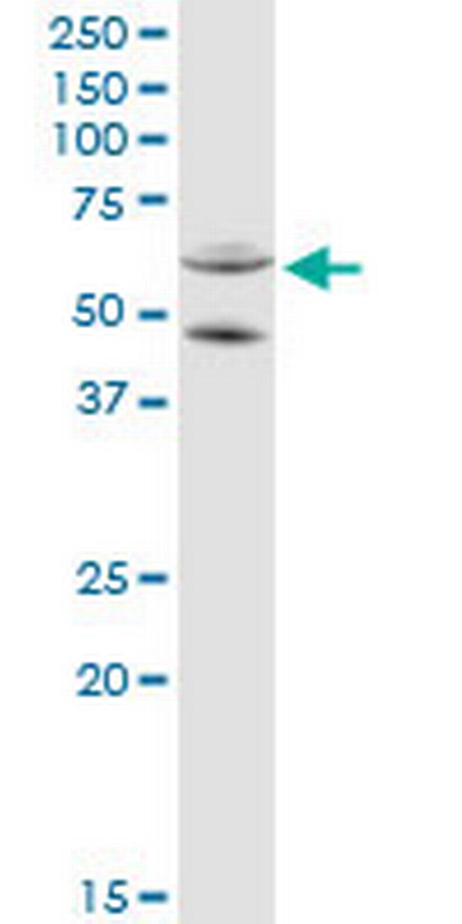 CYP11A1 Antibody in Western Blot (WB)