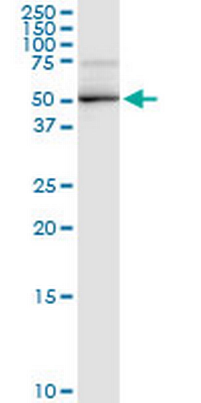 DBT Antibody in Western Blot (WB)