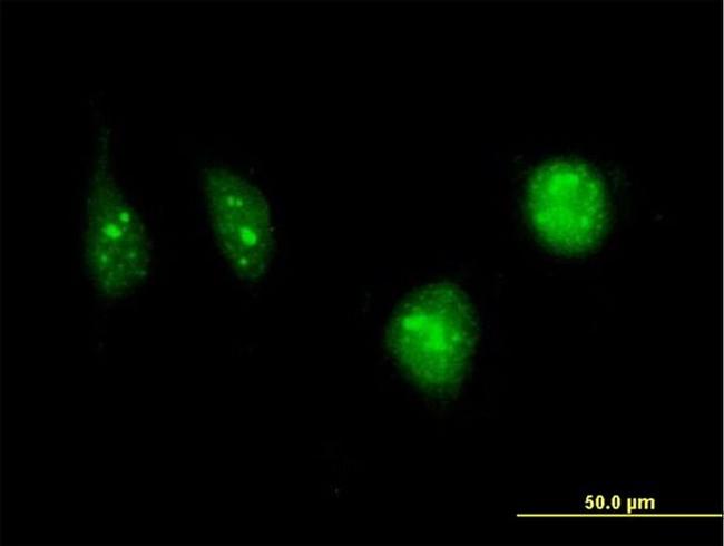 DCK Antibody in Immunocytochemistry (ICC/IF)