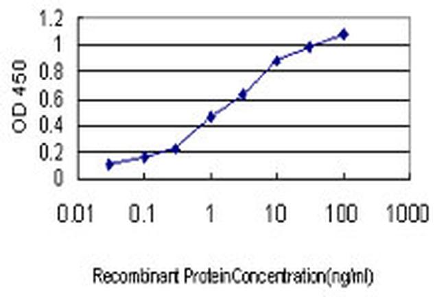 ACE Antibody in ELISA (ELISA)