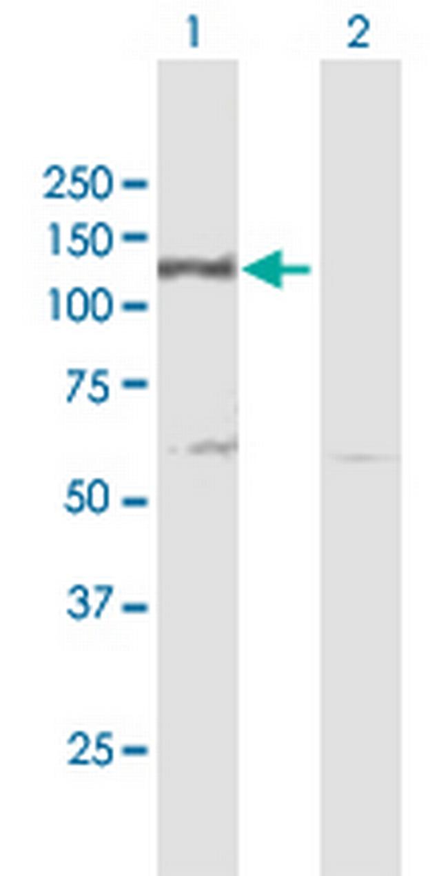 DDB1 Antibody in Western Blot (WB)