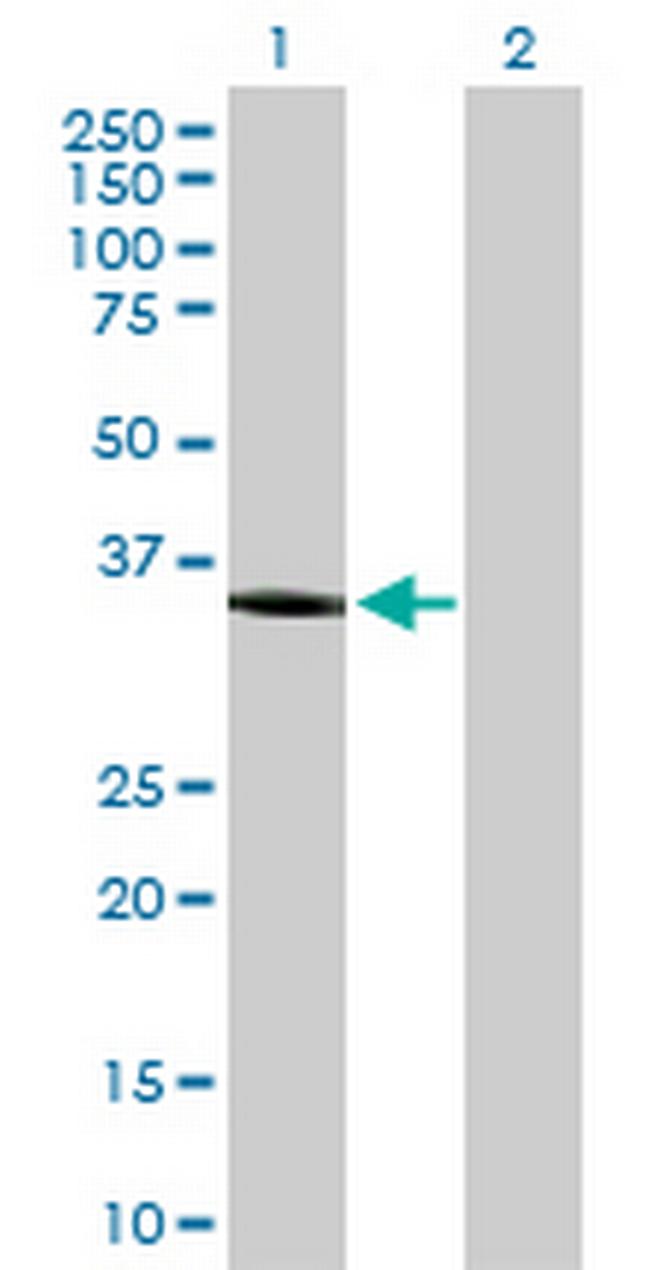 AKR1C1 Antibody in Western Blot (WB)