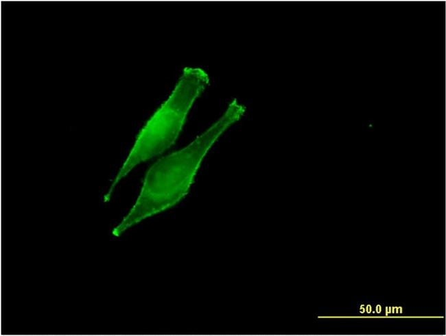 DDOST Antibody in Immunocytochemistry (ICC/IF)