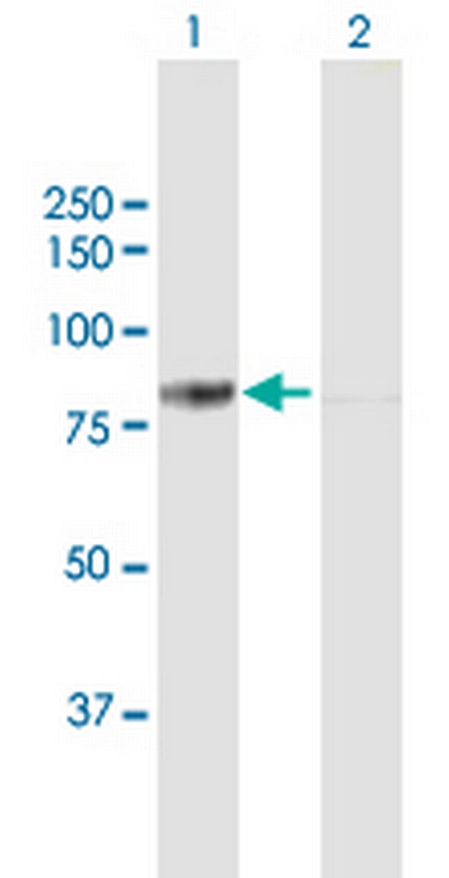 DDX3X Antibody in Western Blot (WB)