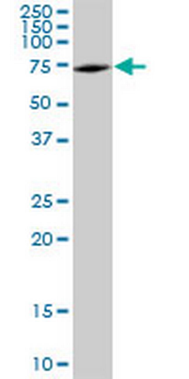 DDX5 Antibody in Western Blot (WB)