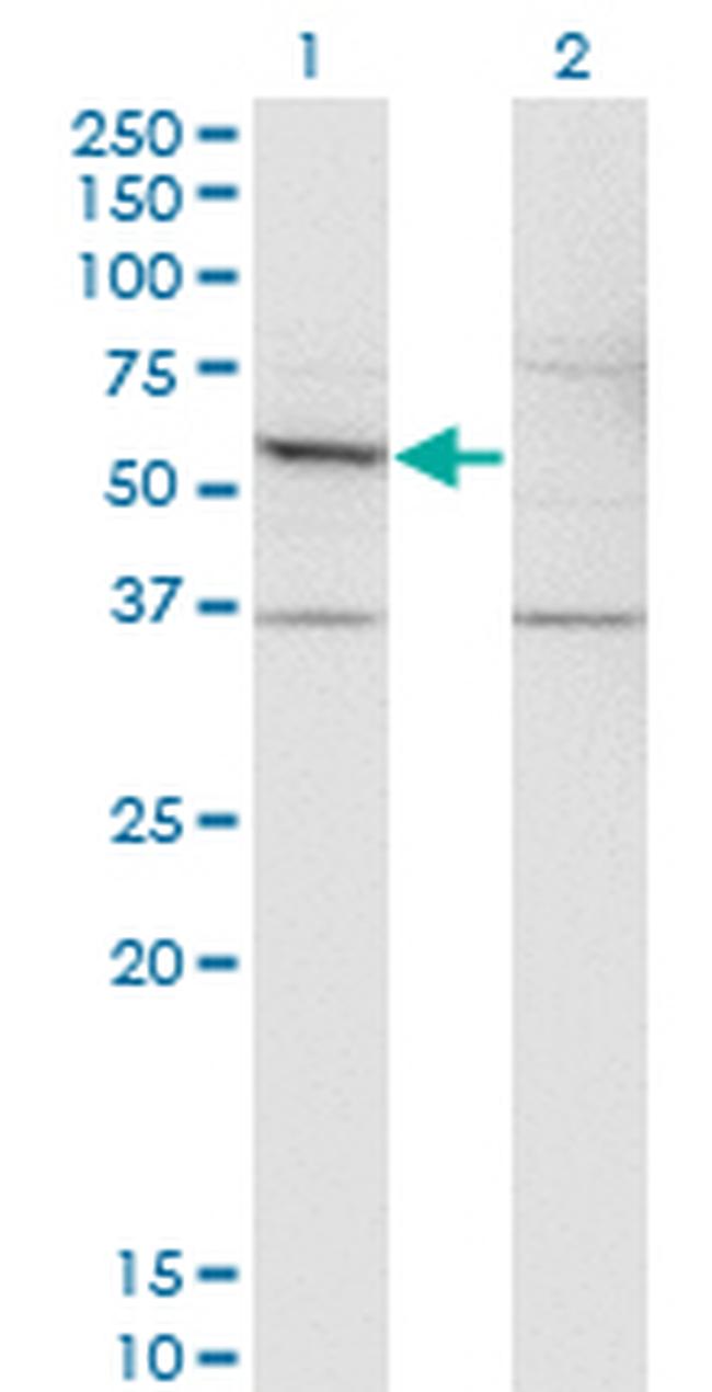 DFNA5 Antibody in Western Blot (WB)