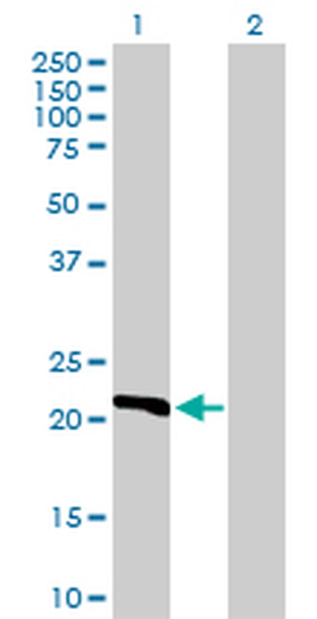 DHFR Antibody in Western Blot (WB)