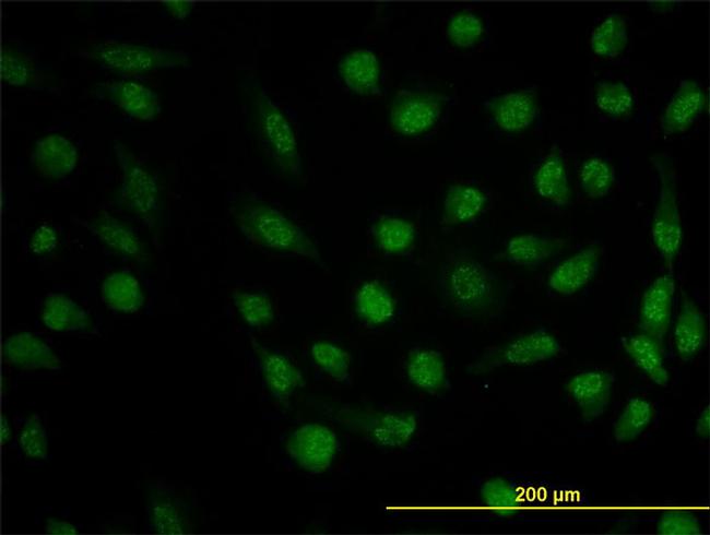 DHFR Antibody in Immunocytochemistry (ICC/IF)