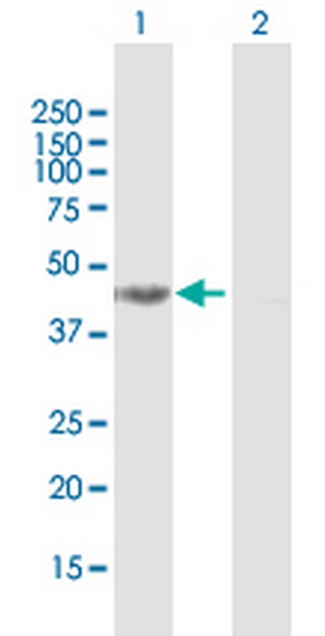 DHPS Antibody in Western Blot (WB)