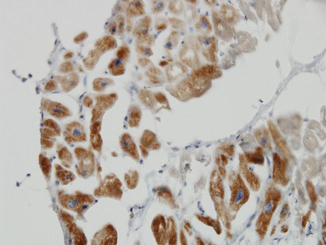 DLD Antibody in Immunohistochemistry (Paraffin) (IHC (P))