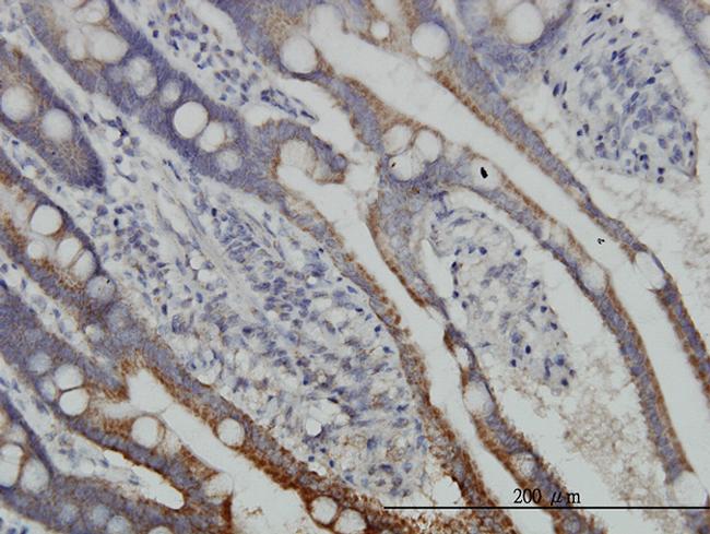 DLD Antibody in Immunohistochemistry (Paraffin) (IHC (P))