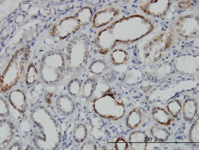 DLD Antibody in Immunohistochemistry (Paraffin) (IHC (P))