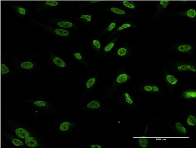 DLX1 Antibody in Immunocytochemistry (ICC/IF)