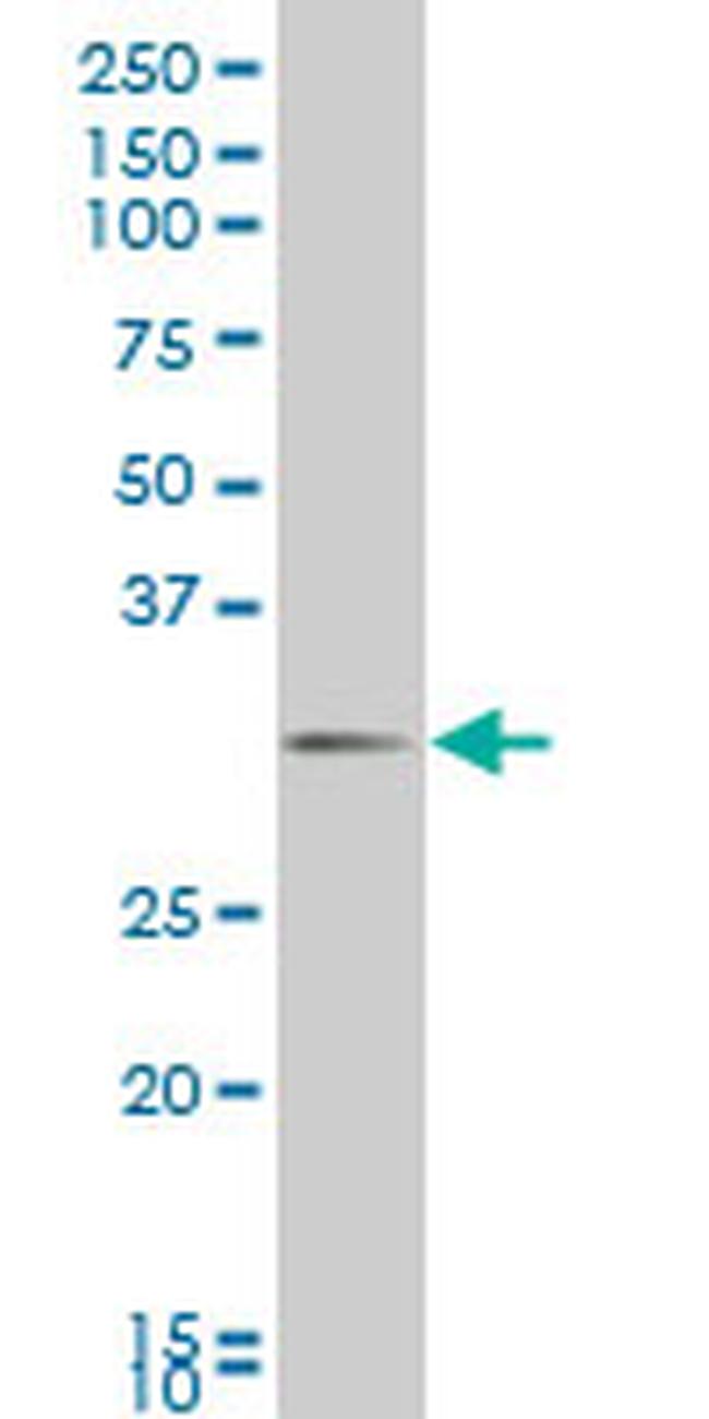 DLX1 Antibody in Western Blot (WB)