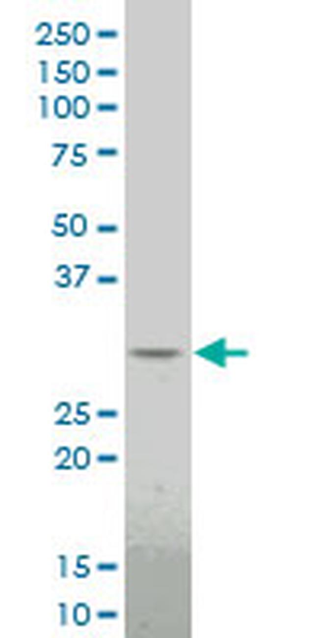 DLX1 Antibody in Western Blot (WB)