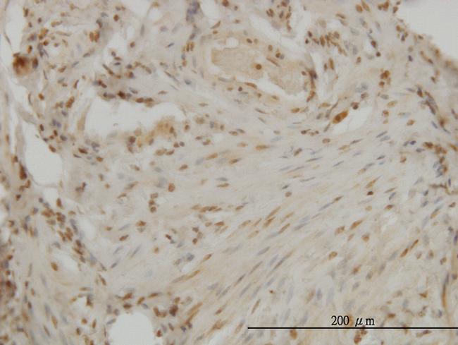 DLX2 Antibody in Immunohistochemistry (Paraffin) (IHC (P))