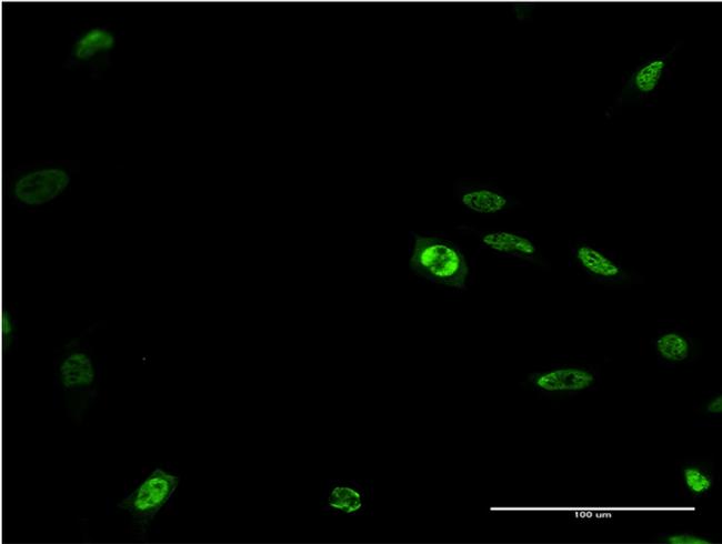 DLX2 Antibody in Immunocytochemistry (ICC/IF)