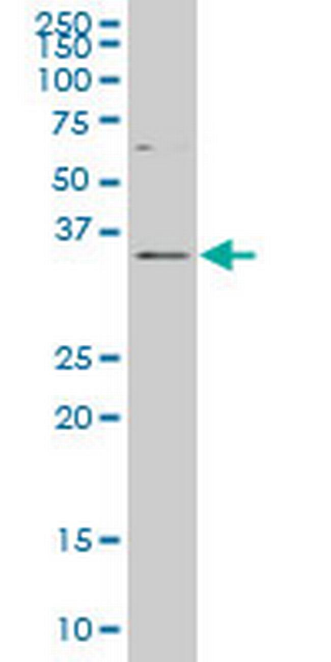 DLX2 Antibody in Western Blot (WB)