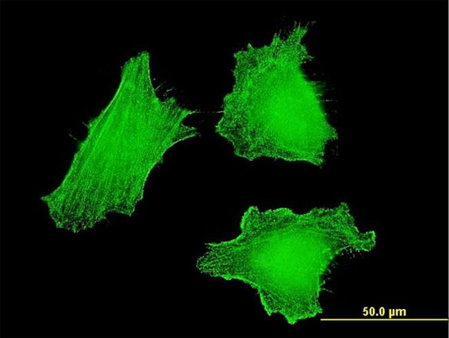 DLX5 Antibody in Immunocytochemistry (ICC/IF)