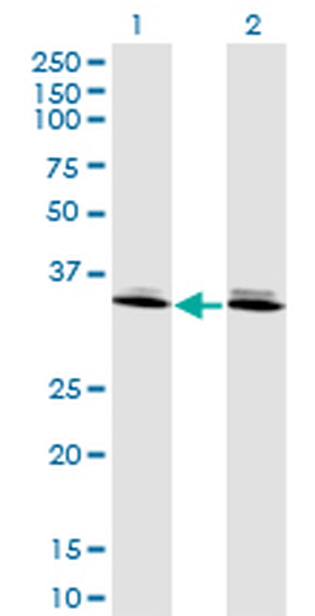 DLX6 Antibody in Western Blot (WB)