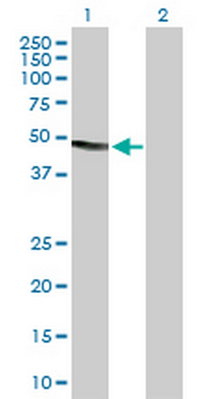 DNASE2 Antibody in Western Blot (WB)