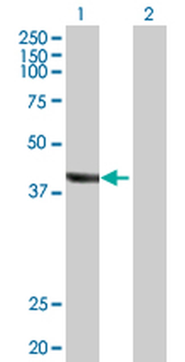 TRDMT1 Antibody in Western Blot (WB)