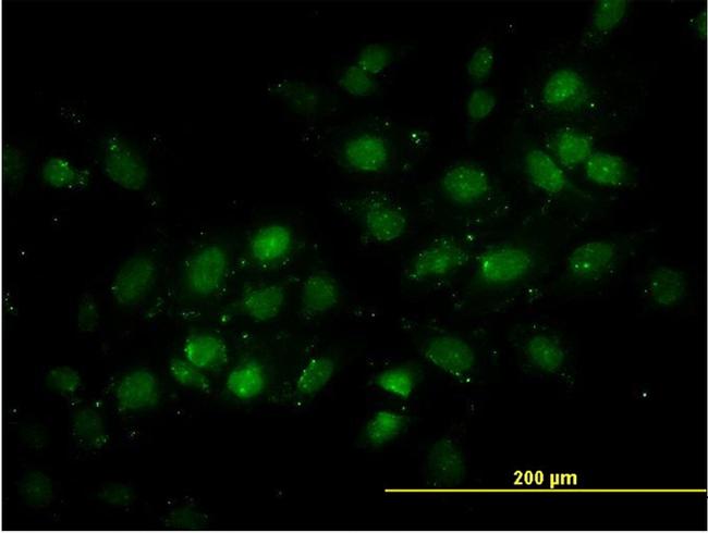 DNMT2 Antibody in Immunocytochemistry (ICC/IF)