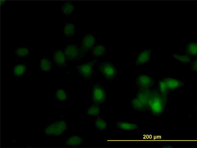 DPH1 Antibody in Immunocytochemistry (ICC/IF)