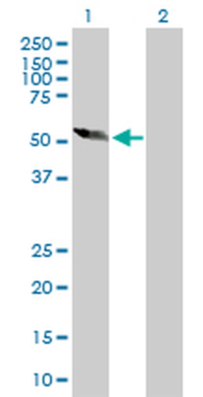 DPH2 Antibody in Western Blot (WB)