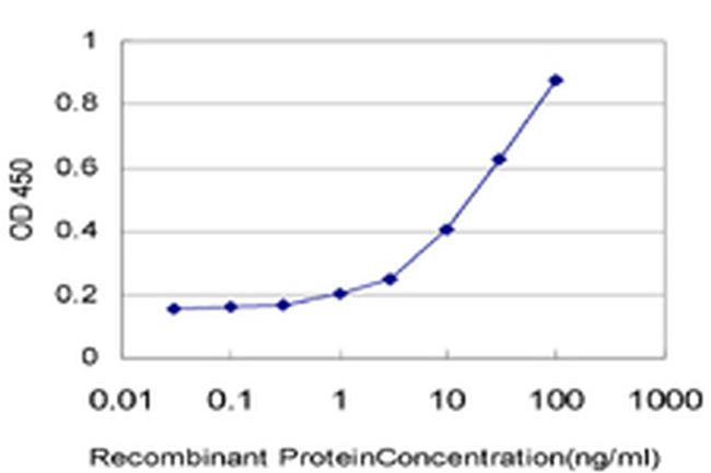 DPP4 Antibody in ELISA (ELISA)