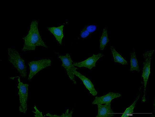 DPYD Antibody in Immunocytochemistry (ICC/IF)