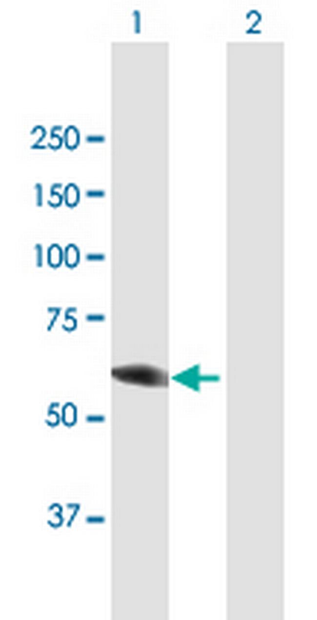 DPYSL3 Antibody in Western Blot (WB)