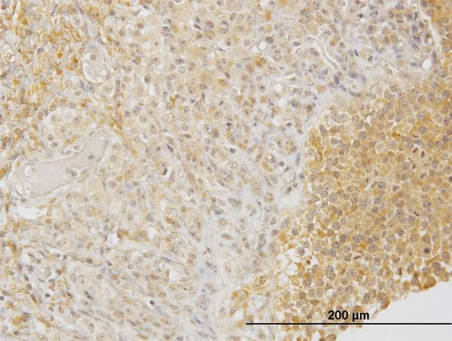 DPYSL3 Antibody in Immunohistochemistry (Paraffin) (IHC (P))