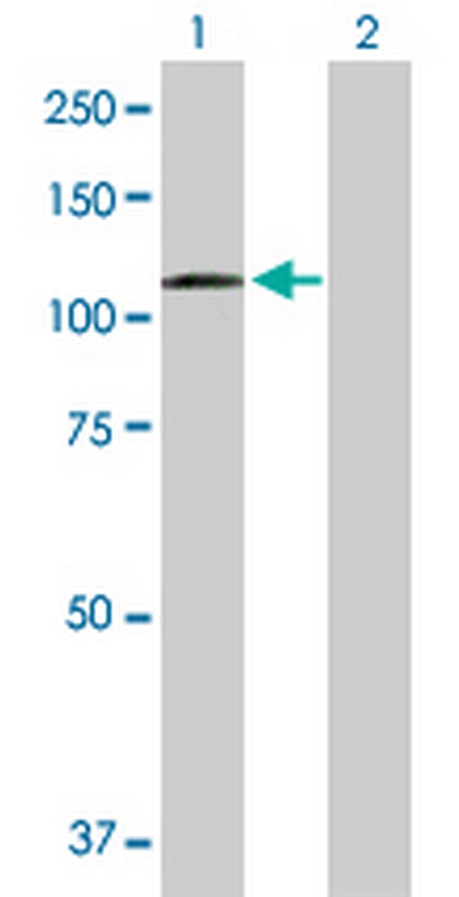 DSC2 Antibody in Western Blot (WB)