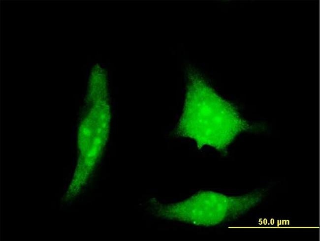 DSCR1 Antibody in Immunocytochemistry (ICC/IF)