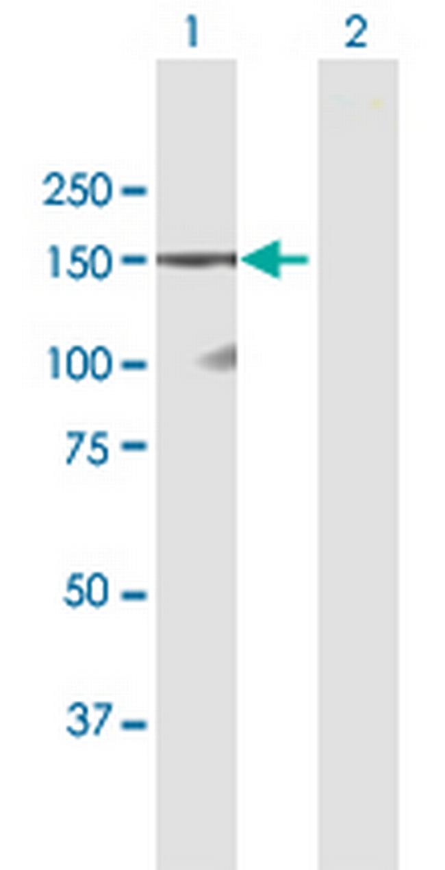 DSG1 Antibody in Western Blot (WB)