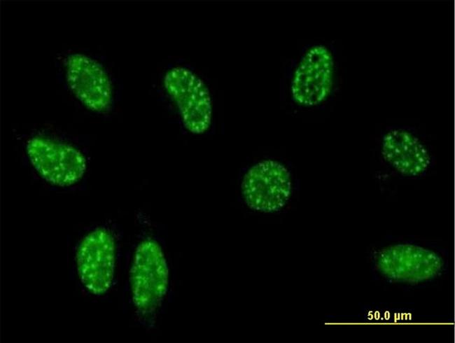 TSC22D3 Antibody in Immunocytochemistry (ICC/IF)