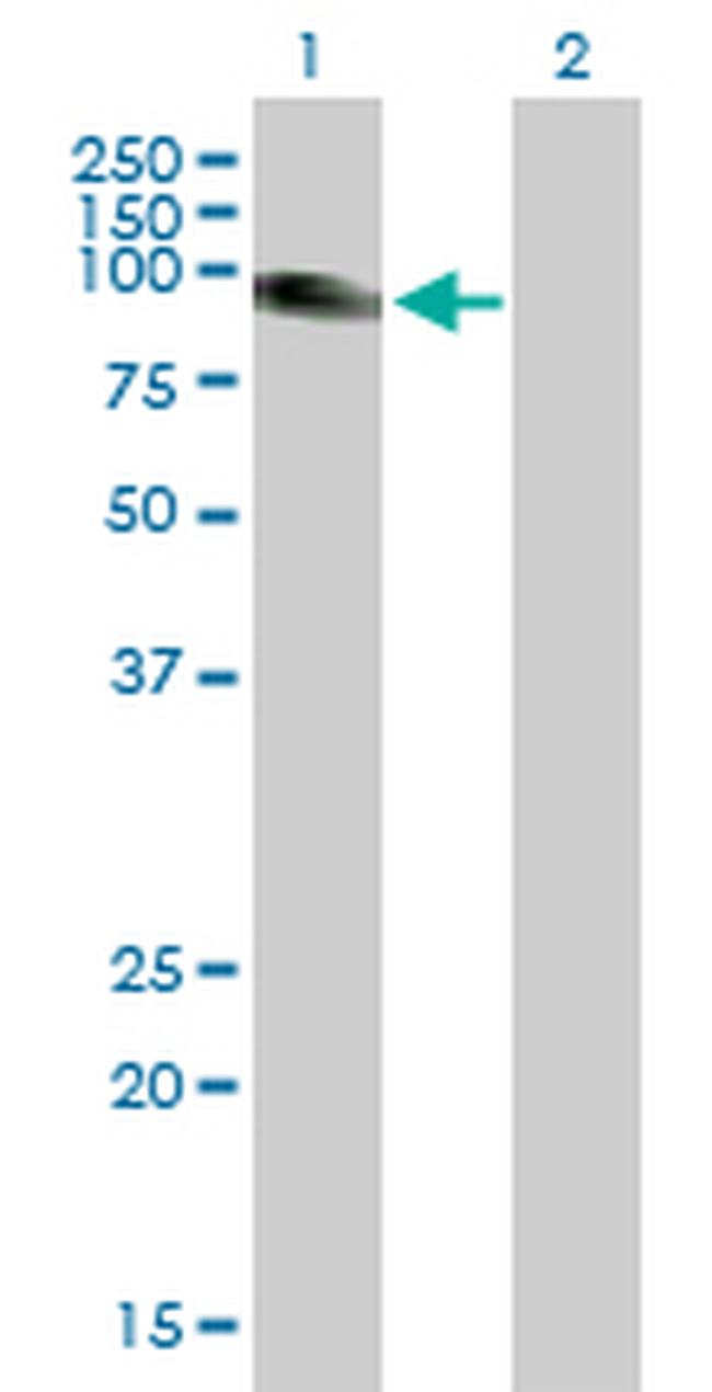 SLC26A2 Antibody in Western Blot (WB)