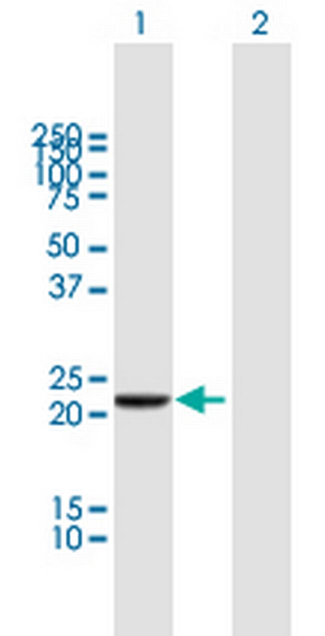 DTYMK Antibody in Western Blot (WB)