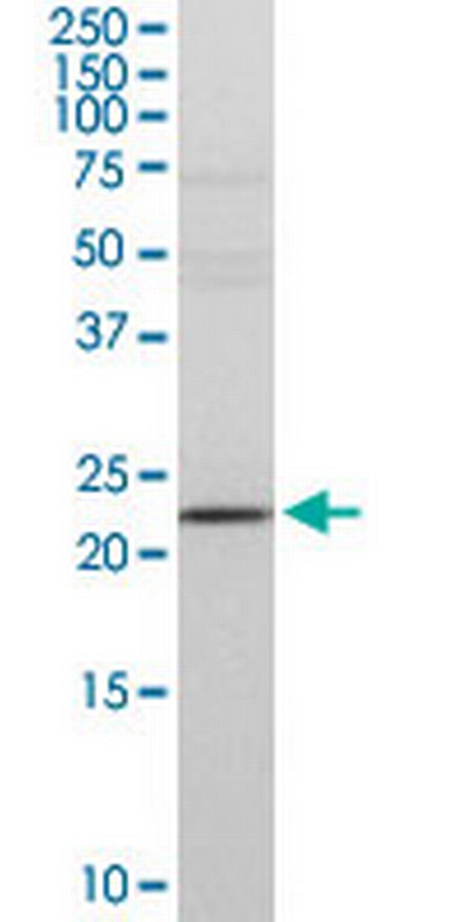 DTYMK Antibody in Western Blot (WB)