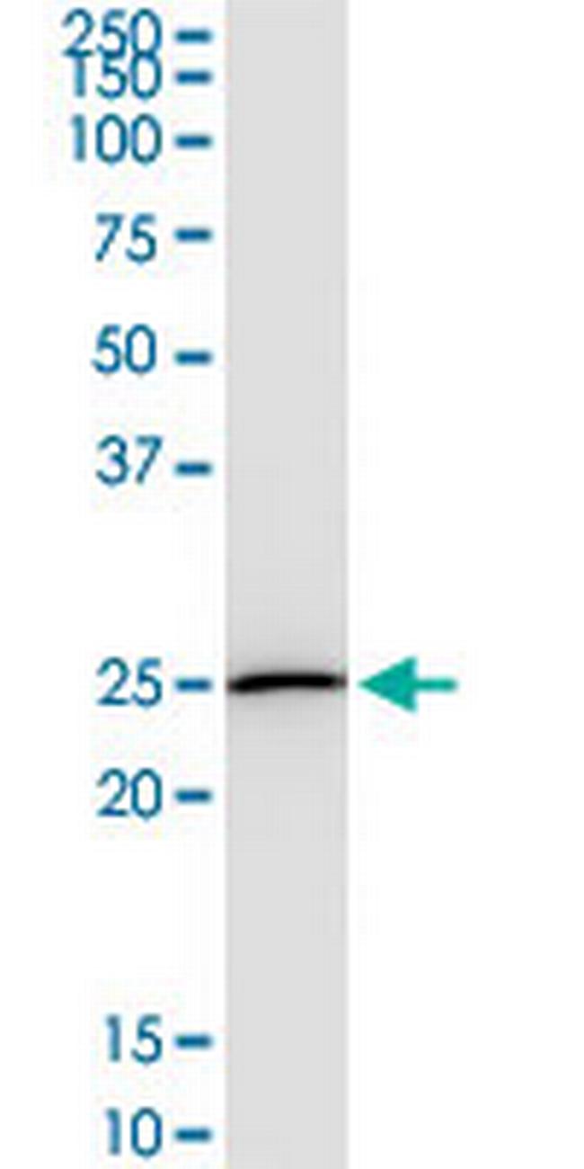 DTYMK Antibody in Western Blot (WB)