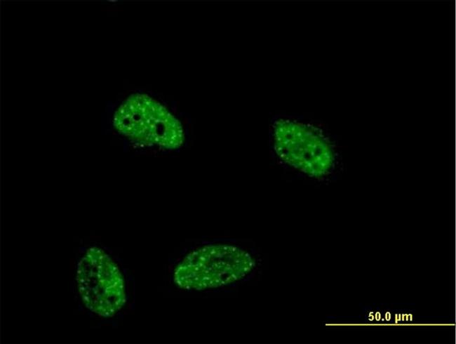 DUSP4 Antibody in Immunocytochemistry (ICC/IF)