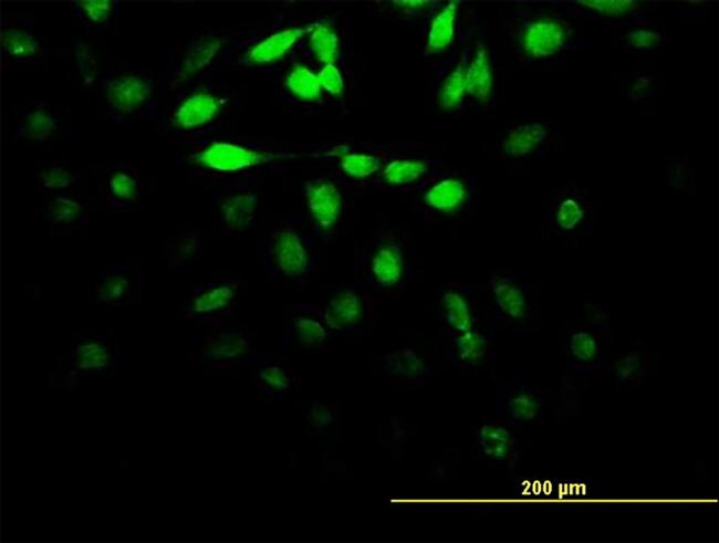 DUSP5 Antibody in Immunocytochemistry (ICC/IF)