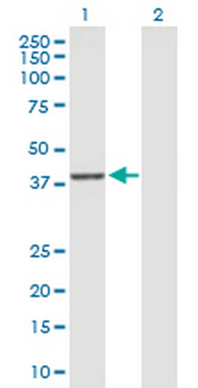 DUSP9 Antibody in Western Blot (WB)