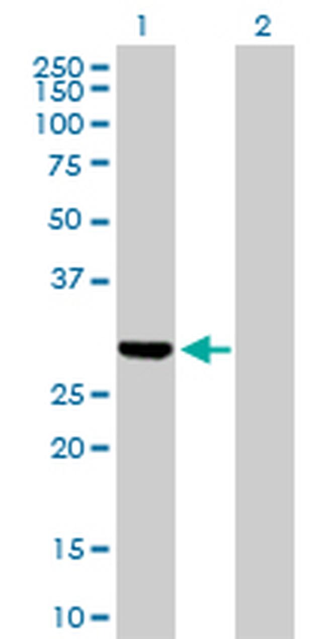 DUT Antibody in Western Blot (WB)